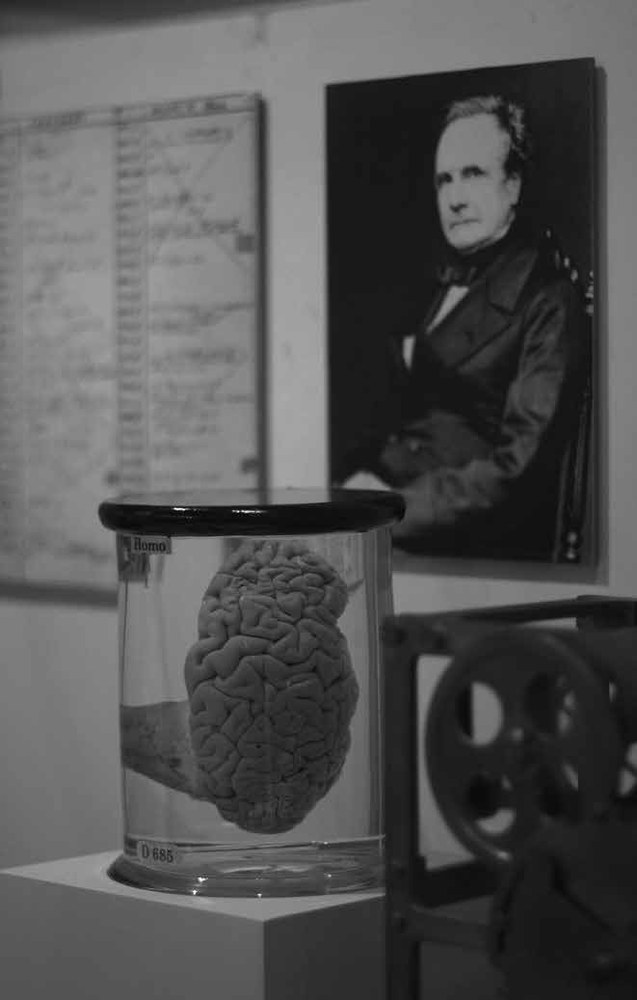 Charles Babbage's preserved brain on display at the London Science Museum
