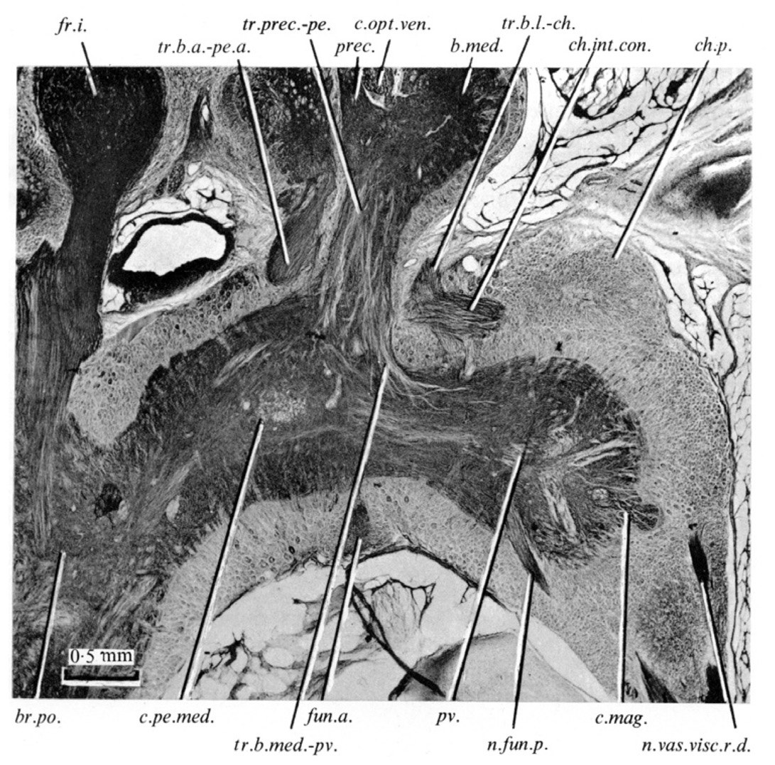 A labelled microscope section of an octopus brain